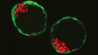 Cientistas criam primeiros embriões inteiramente artificiais - TVI