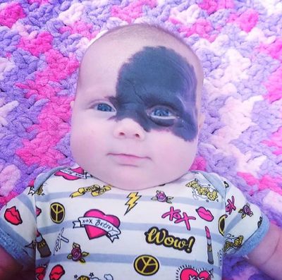 A marca que está a tornar esta bebé numa "super-heroína" - TVI