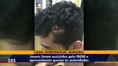 Casal homossexual brutalmente agredido em Coimbra - TVI