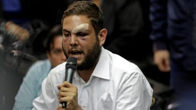 Deputado da oposição detido por participação em ataque contra Maduro - TVI