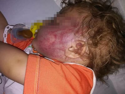 Padrasto que agrediu bebé de 17 meses provocou-lhe "dores e hematomas" - TVI