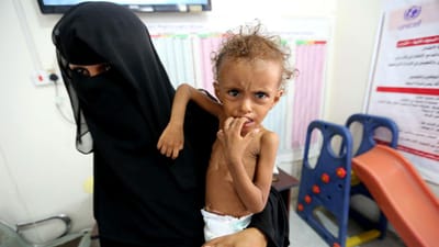 Pandemia e falta de ajuda empurram milhões de crianças no Iémen para a fome - TVI