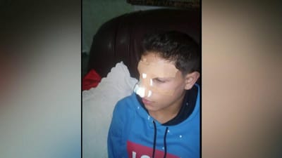 Jovem de 14 anos agredido por três colegas na escola - TVI