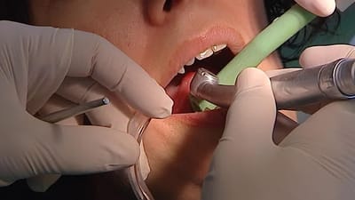 Metade dos portugueses não vai ao dentista - TVI