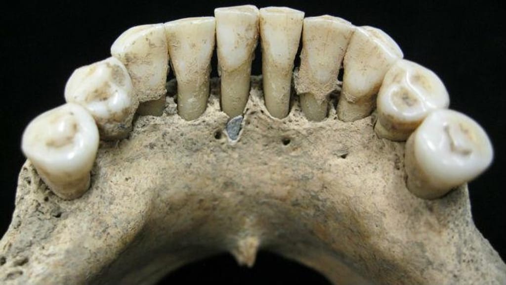 Dentição medieval