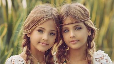 Estas gémeas são consideradas as mais bonitas do mundo - TVI