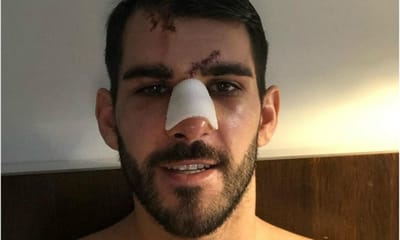 FOTO: Nelson Oliveira já cura as feridas em casa - TVI
