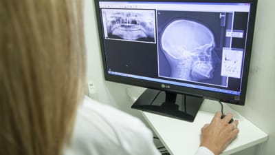 Atenção, há formações online de radiologia não fiscalizadas - TVI