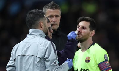 «Messi parece ter sido atropelado por um camião» - TVI