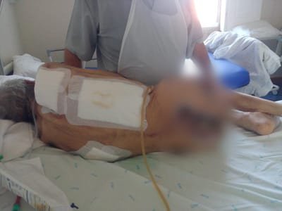 Repórter TVI: maus-tratos e negligência no hospital Conde de Ferreira sob investigação - TVI