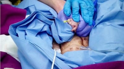 INEM divulga a primeira foto do recém-nascido encontrado no lixo - TVI