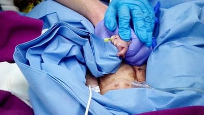 Mãe de bebé encontrado no lixo fica em prisão preventiva - TVI