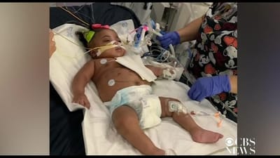 Tribunal autoriza hospital a desligar máquinas que mantêm bebé de 11 meses viva - TVI