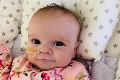 Bebé "milagre" sobrevive ao coronavírus depois de nascer com problema cardíaco - TVI
