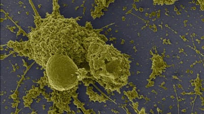 Covid-19: novas imagens mostram como é que o vírus se espalha entre as células - TVI