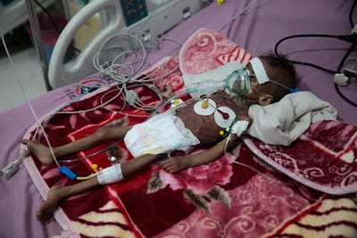 Mais de 100 mortos em três dias no Iémen após confrontos em Marib - TVI