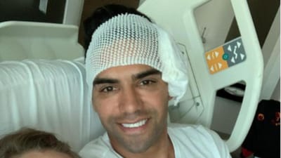 FOTO: Falcao operado com sucesso a fratura no rosto - TVI