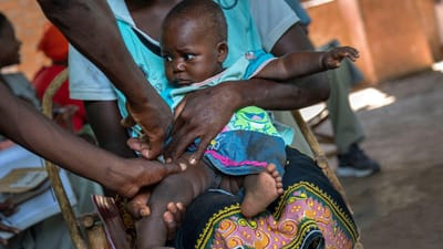 Mais de 16 milhões de crianças falharam vacinação do sarampo em África - TVI