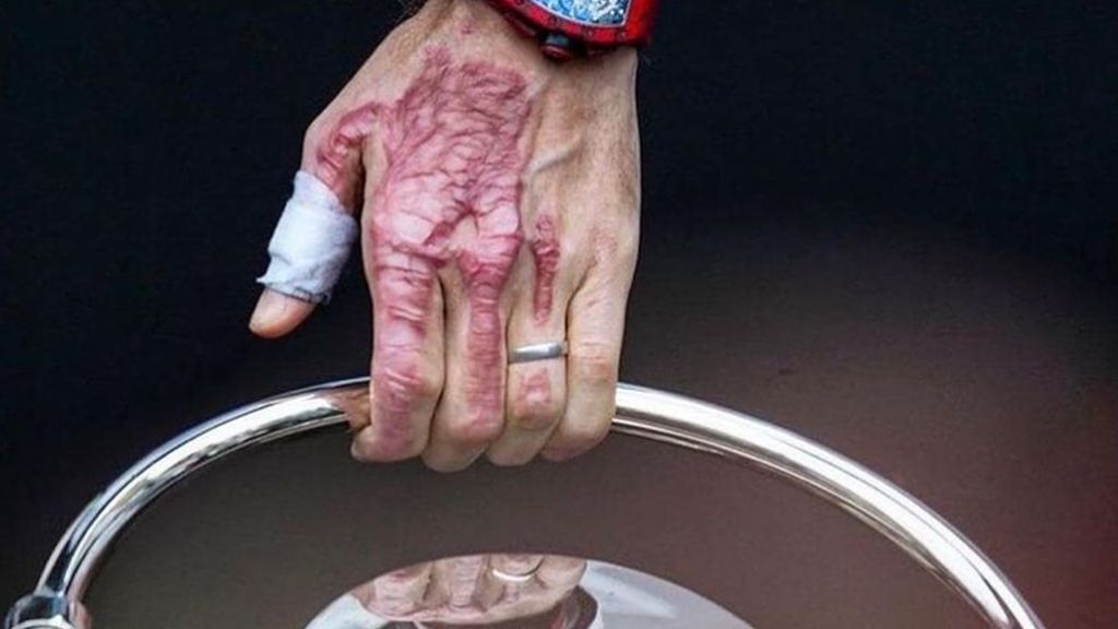 Mão de Romain Grosjean (Grace Alivia Hollars)