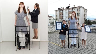 Turca de 24 anos é a mulher mais alta do mundo - TVI
