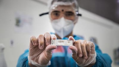 Ómicron já é responsável por 93,2% das infeções em Portugal. INSA fala em "crescimento galopante" - TVI