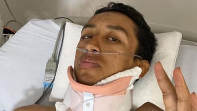 Bernal após acidente: «Tive 95 por cento de probabilidade de ficar paraplégico» - TVI