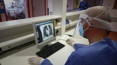 “Somos um dos países que mais transplanta no mundo”: Portugal atinge "recorde" no transplante pulmonar - TVI