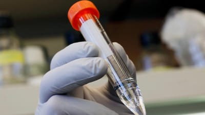 Nem todos os vírus são maus: este salvou um homem de uma bactéria resistente a todos os antibióticos - TVI