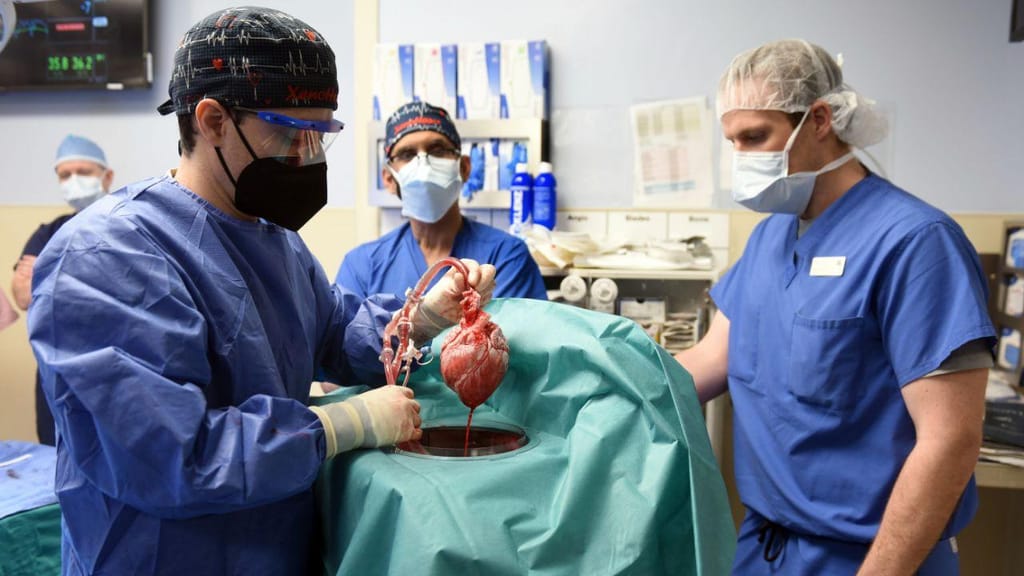 Transplante de coração de porco para humano (Mark Teske/Escola de Medicina da Universidade de Maryland/AP Photo)