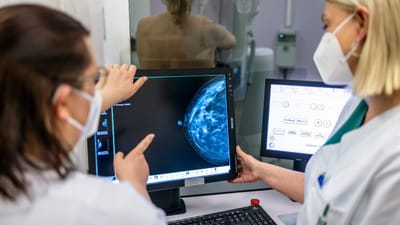 Apenas 36% aderiram ao despiste do cancro do cólon e reto e metade das mulheres não fez o rastreio à mama em 2022 - TVI