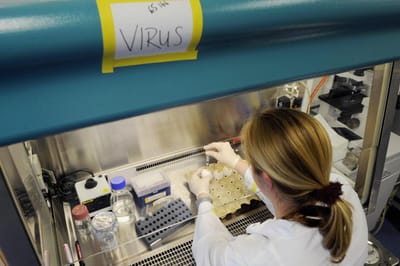Autoridades espanholas anunciam que caso suspeito afinal não era vírus Marburg - TVI
