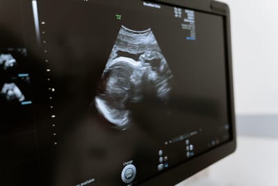 Aborto: deputados do PS querem ouvir a Diretora-Geral de Saúde no Parlamento - TVI