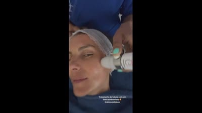 Joana Seixas: Tratamento facial - TVI