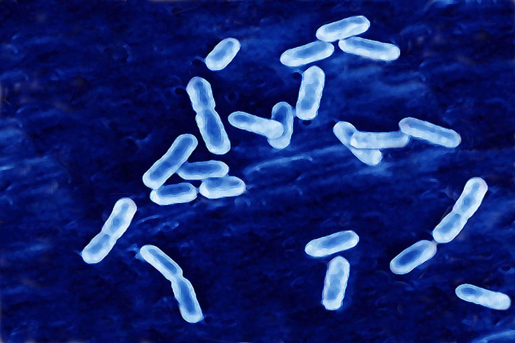 Listeria (BSIP/Universal Images Group/Getty Images)