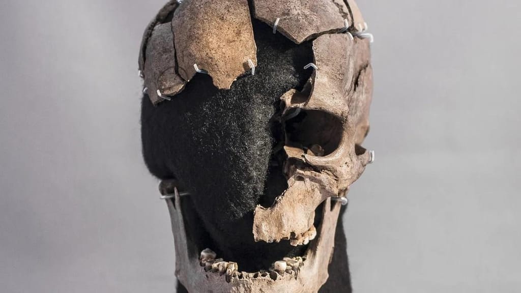 Crânio fragmentado do Homem de Vittrup (Stephen Freiheit)