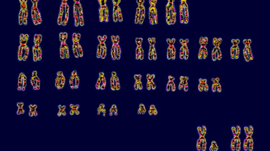 Os humanos têm 23 pares de cromossomas. No canto inferior direito estão os pares de cromossomas sexuais XY ou XX que determinam o sexo (BSIP/Universal Images Group/Getty Images)