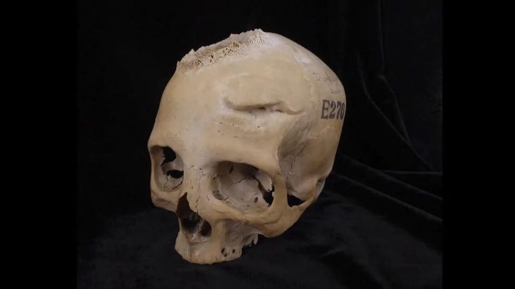 Skull E270 (Courtesy Tondini, Isidro, Camarós)