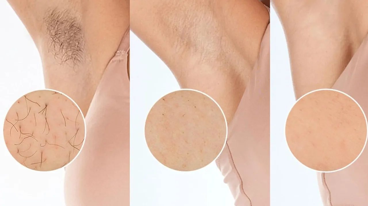 Philips Lumea série 9900