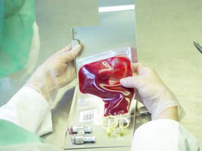 Já é possível fazer sangue a partir de células da pele - TVI