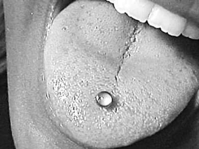 Mulher tem mais de 6 mil piercings - TVI
